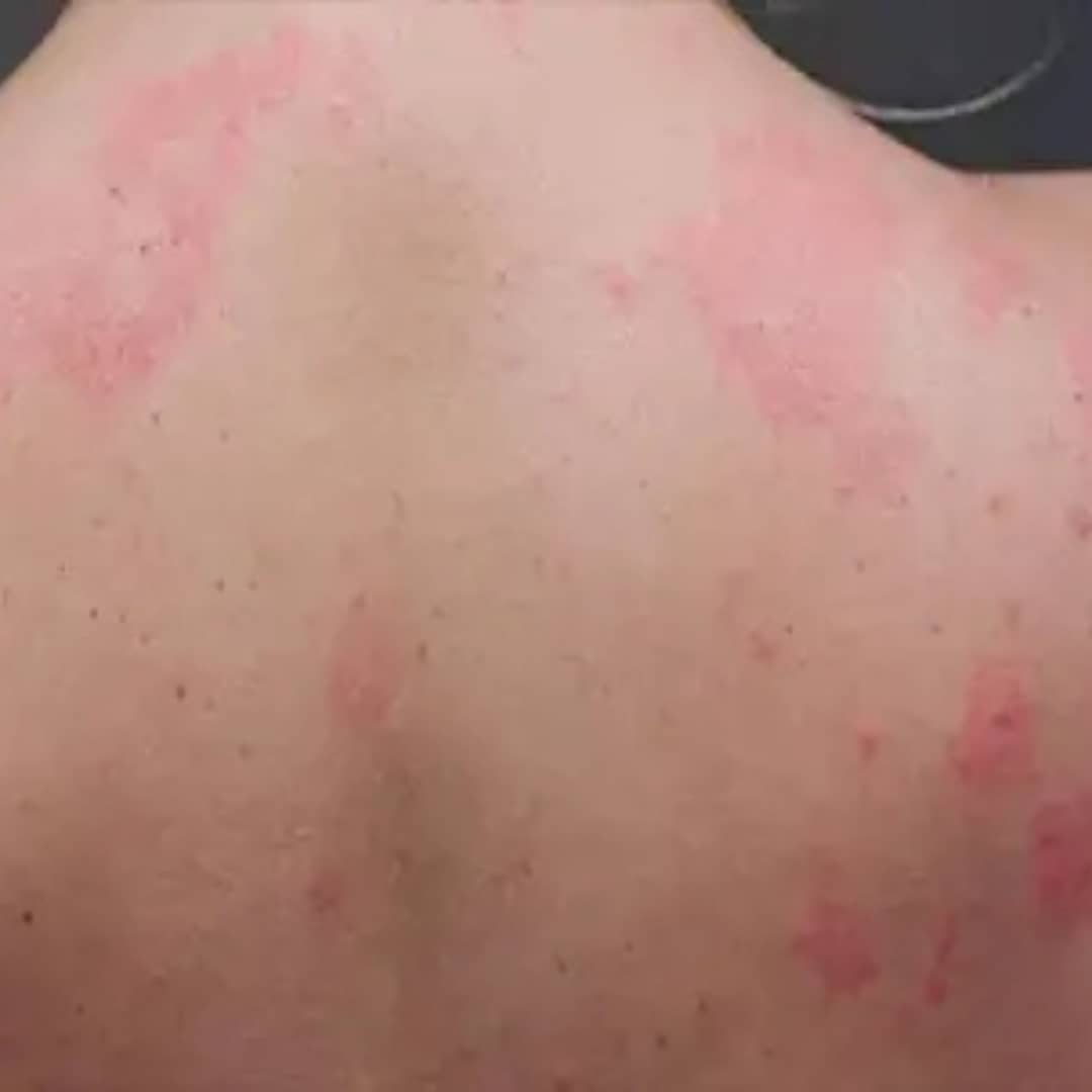 ارتفاع شديد في الحرارة